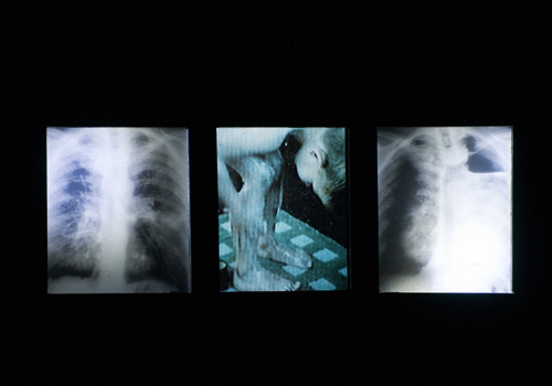 Christoph Schlingensief "Innocence, 1965-2008", 2008. <em>fotograaf: Cassander Eeftinck Schattenkerk</em> Cassander Eeftinck Schattenkerk