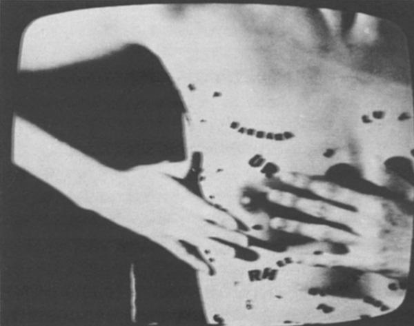Hannah Wilke © De Appel, Amsterdam & de kunstenaar(s)/the artist(s)